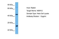 WDR12 Antibody, Novus Biologicals 100 &mu;L; Unconjugated:Antibodies, Polyclonal
